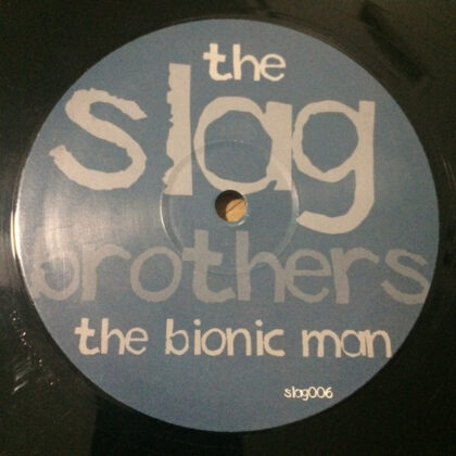 The Slag Brothers – The Bionic Man